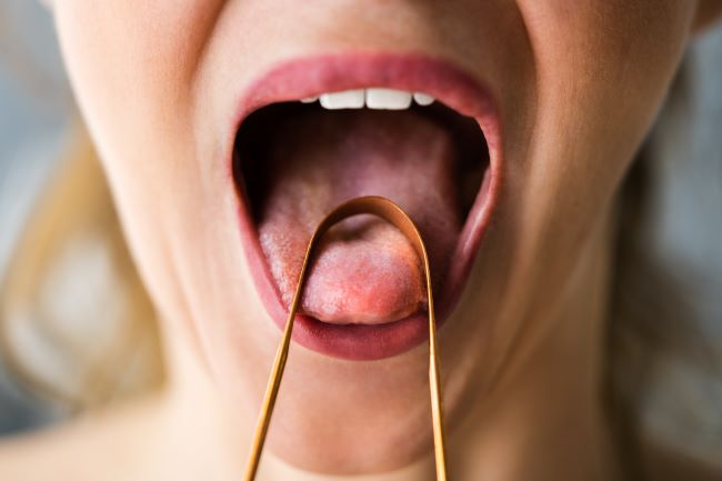 Ženská ústná dutina s vyplazeným jazykom a na ňom je položena medená škrabka na jazyk.