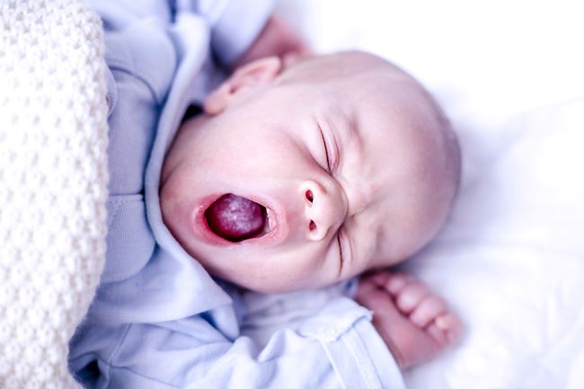 tvár novorodenca zíva a na jazyku má biely povlak. Spí v modrom oblečení