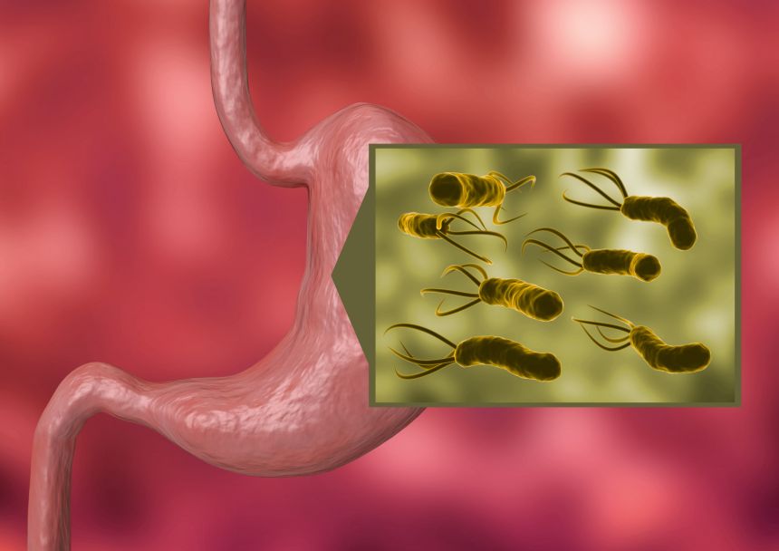 Ilustrácia žalúdku a baktérie Helicobacter pylori. prírodné antibiotikum masticha